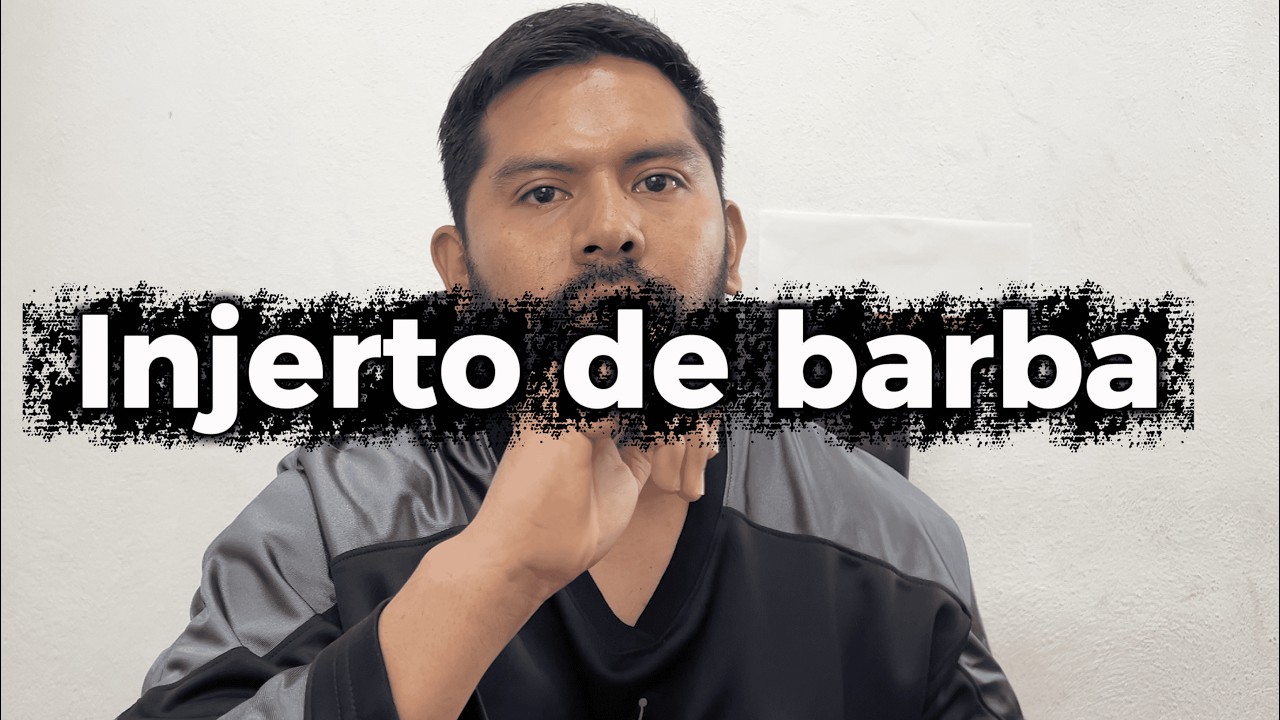 Injerto de barba| Preguntas Frecuentes