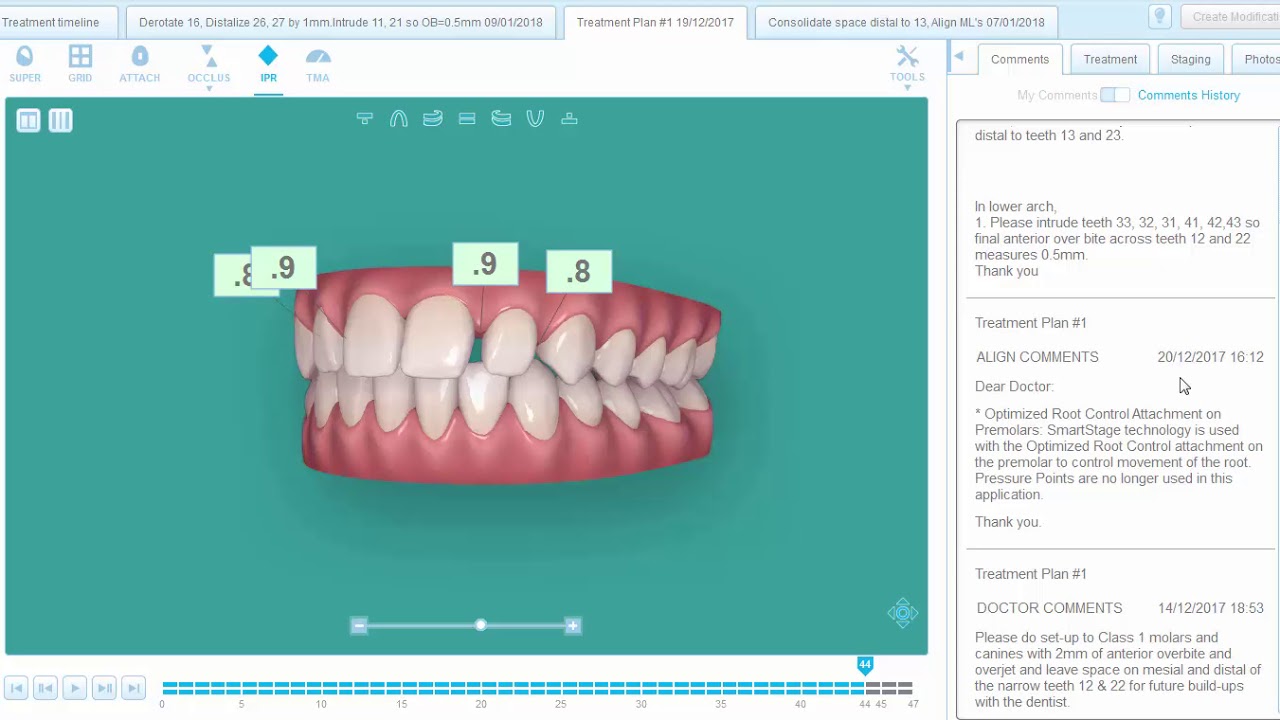 Gaps in teeth and the role of Orthodontists in your smile plan