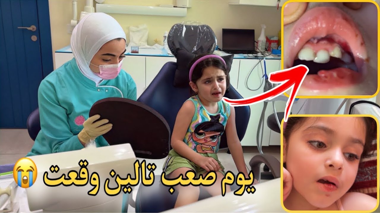 تالين وقعت وورم وجها | انهارت عند دكتورة الأسنان 😭