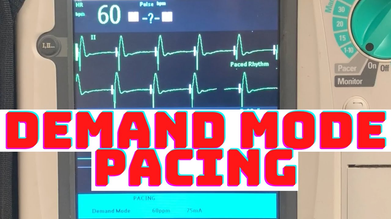 How to Properly Initiate Demand Mode TCP Transcutaneous Cardiac Pacing? Why is it Safer over Fixed?