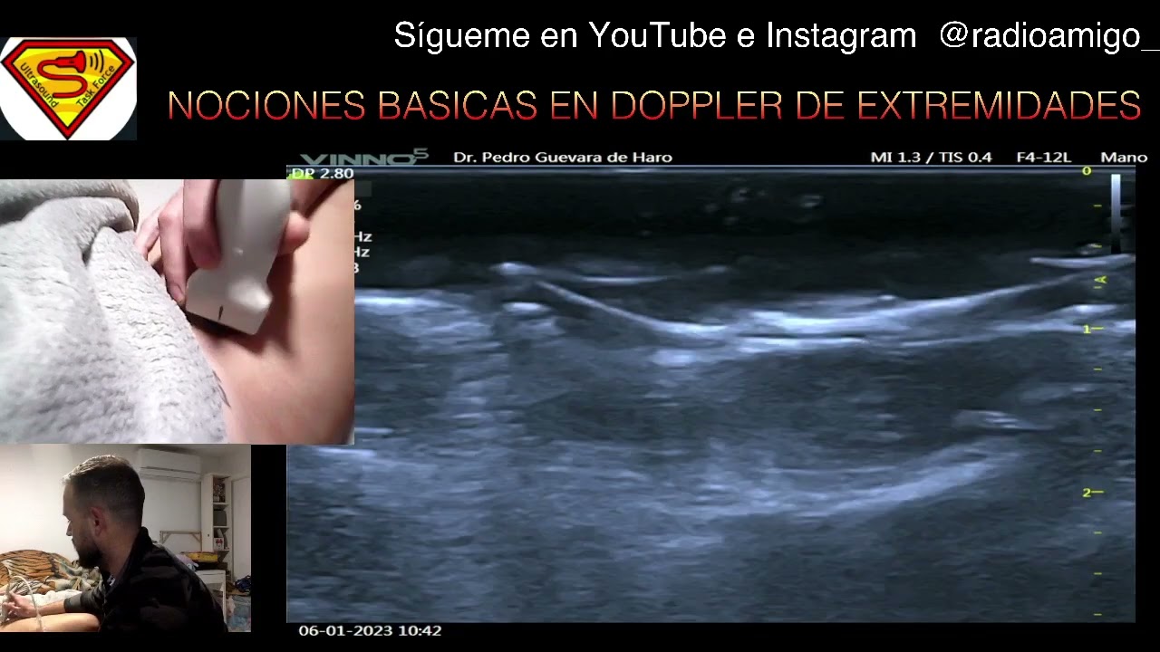 DIFERENCIAR ARTERIAS DE VENAS - NOCIONES BASICAS ULTRASONIDO DOPPLER