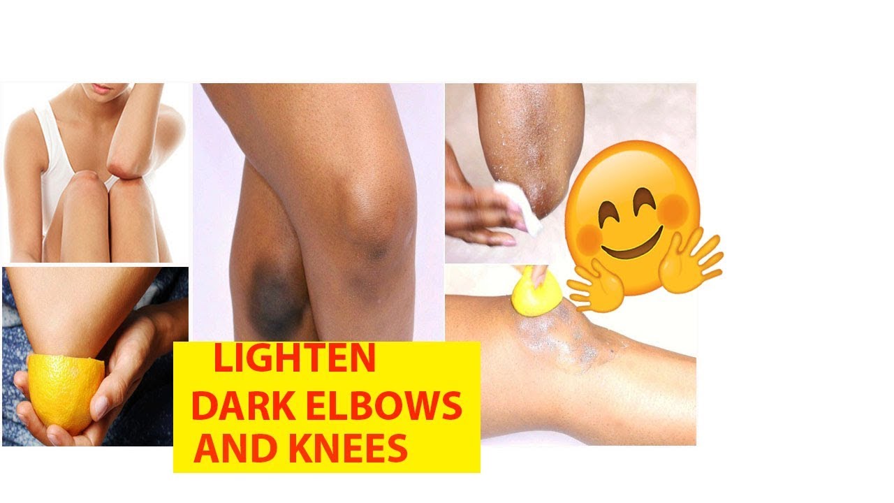 How To Lighten Dark Knees And Elbows In One Week