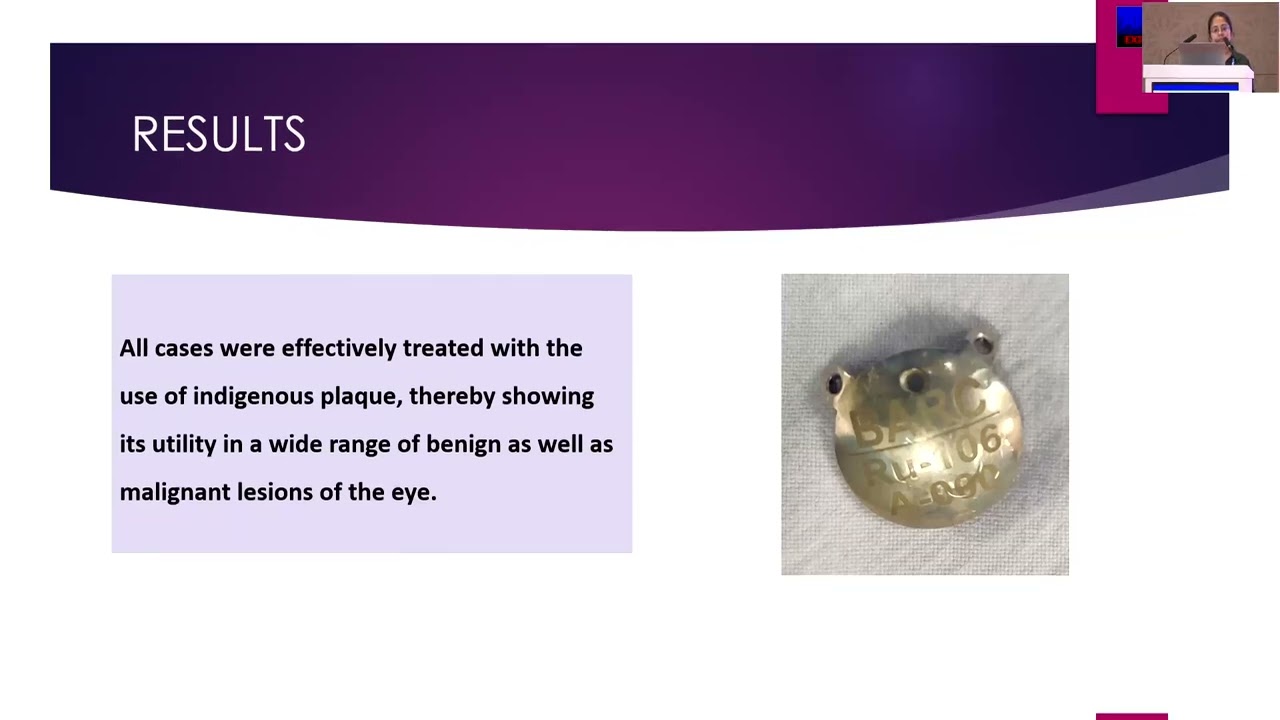 AIOS2025 FP Ocular I FP1968 Dr Aruja GANGWANI Indigenous Ruthenium Plaque Brachytherapy for Ocula