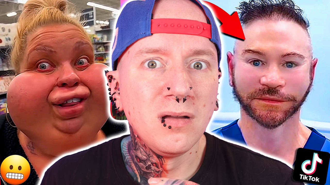 Plastic Surgery Going TOO FAR! | Unhinged TikTok Videos 12