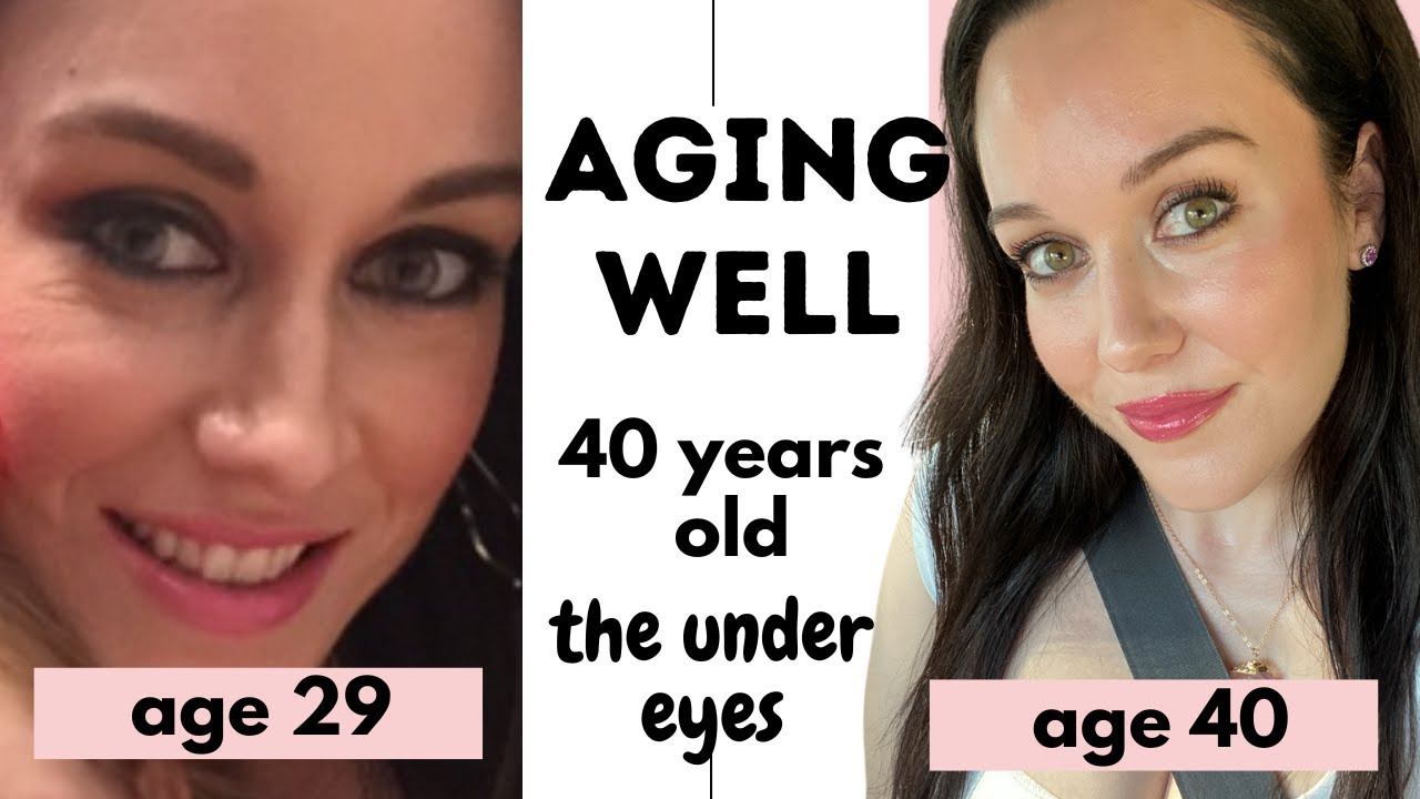 Aging Backwards/Aging Well- The under eye area- 40 years old