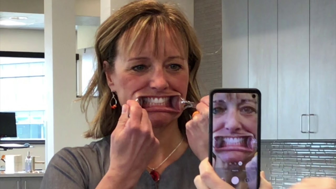 Instructional Video | how to take photos of your mouth and teeth