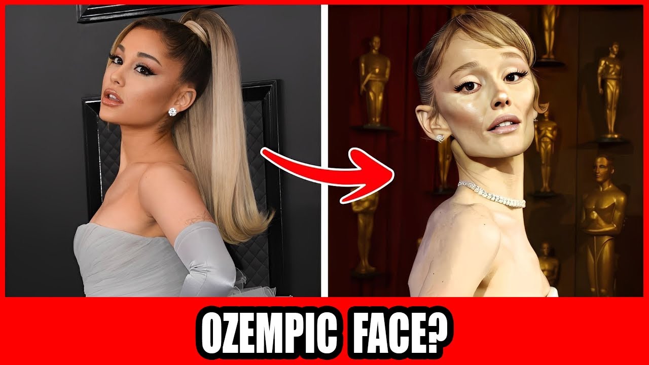 35 Celebrities Whose Faces Changed Overnight Because Of Ozempic!