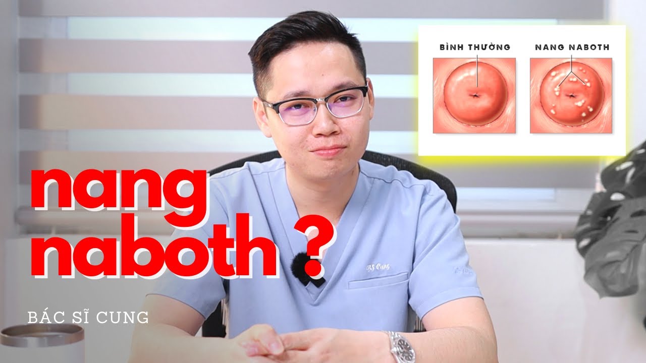 NANG NABOTH có nguy hiểm không ? - Bs Cung