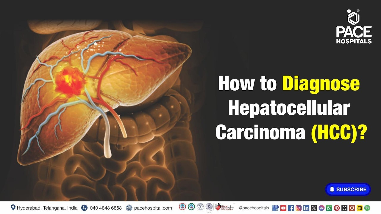 How to Diagnose Hepatocellular Carcinoma (HCC)? | Hepatocellular Carcinoma Diagnosis #hcc