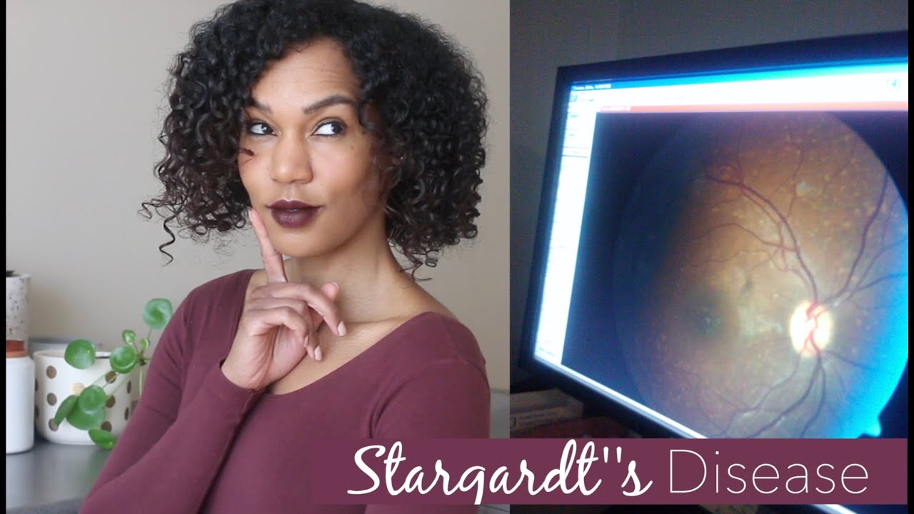 What's Stargardt'sDisease? | What Do Blind People See?