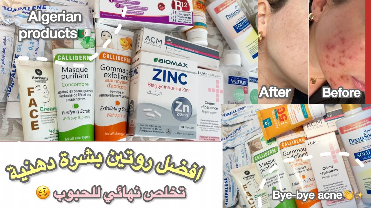 مضيعيش وقتك ودراهمك💸افضل روتين للبشرة دهنية✨كيفاش صفيت وجهي من حبوب🌸بمنتجات جزائرية 🇩🇿🧴
