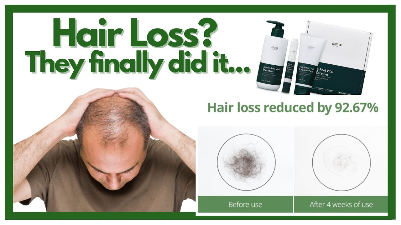 The Answer to Hair Loss?