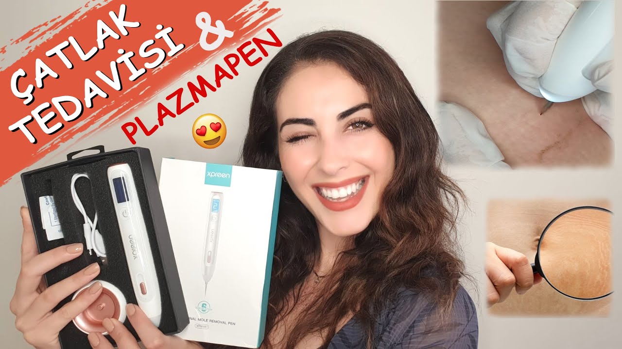 PLAZMAPEN İLE ÇATLAKLARIMDAN NASIL KURTULDUM ? (KESİN ÇÖZÜM!)│Uygulamalı Xpreen Plazmapen