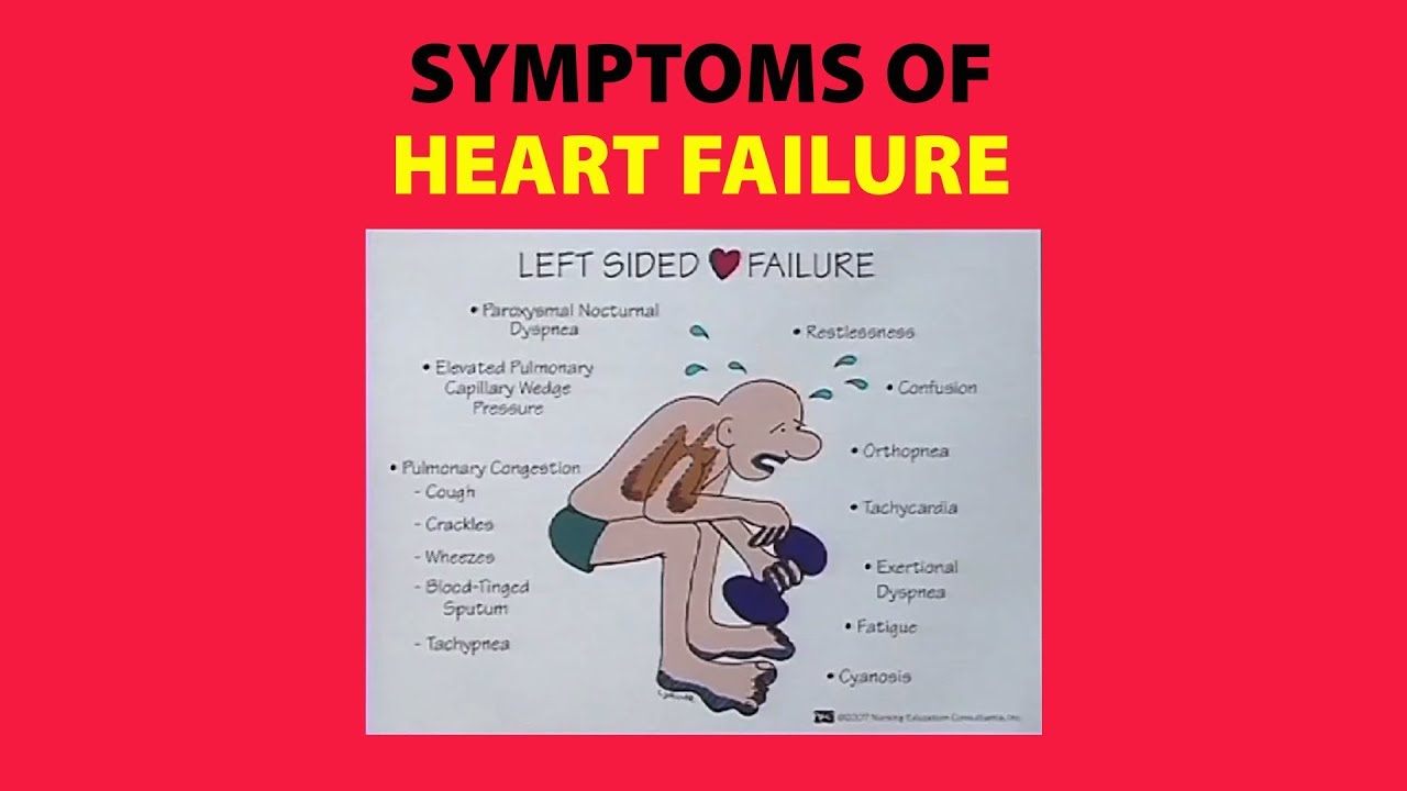 Symptoms of Heart Failure