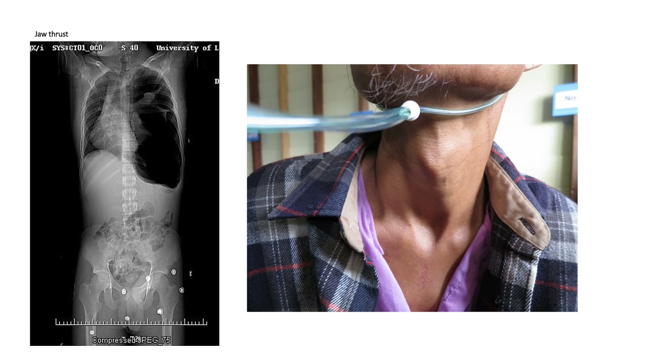 Intro to Trauma Nursing Care