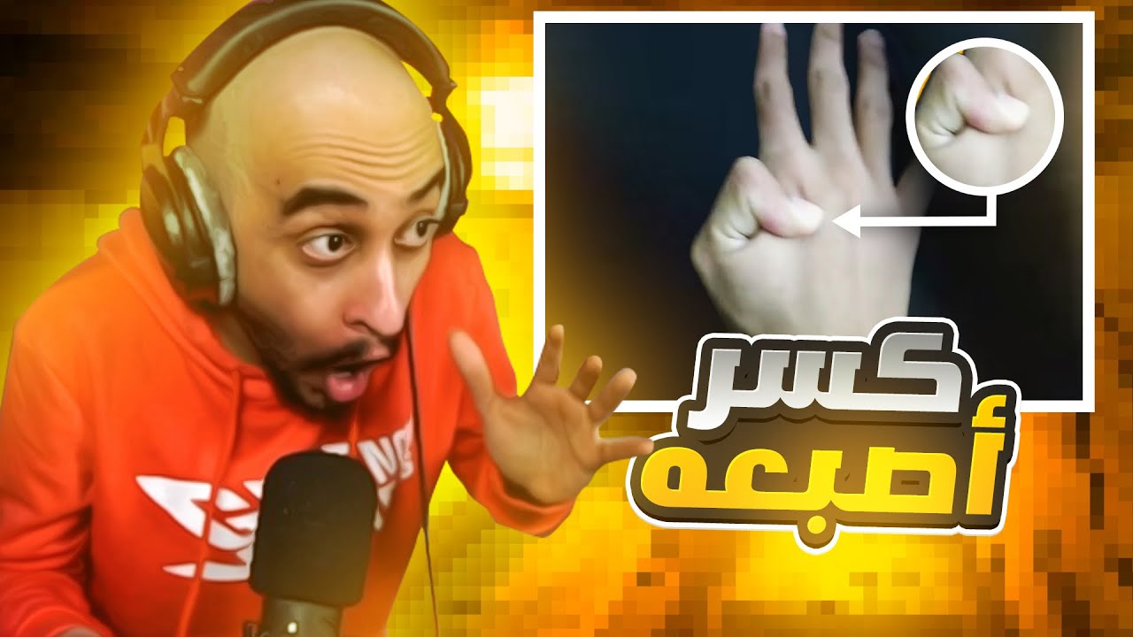 ولد يكسر اصبعه وحصلنا مغني راب ! 🤯 | مواهب #بني_دربحه 🔥💪🏻