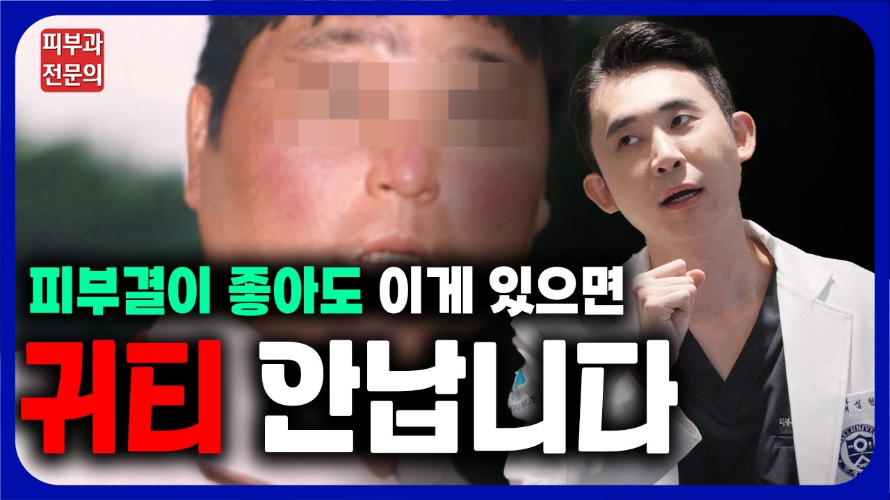 지긋지긋한 안면홍조! 치료가 가능할까요? - 안면홍조 원인, 관리, 치료법!