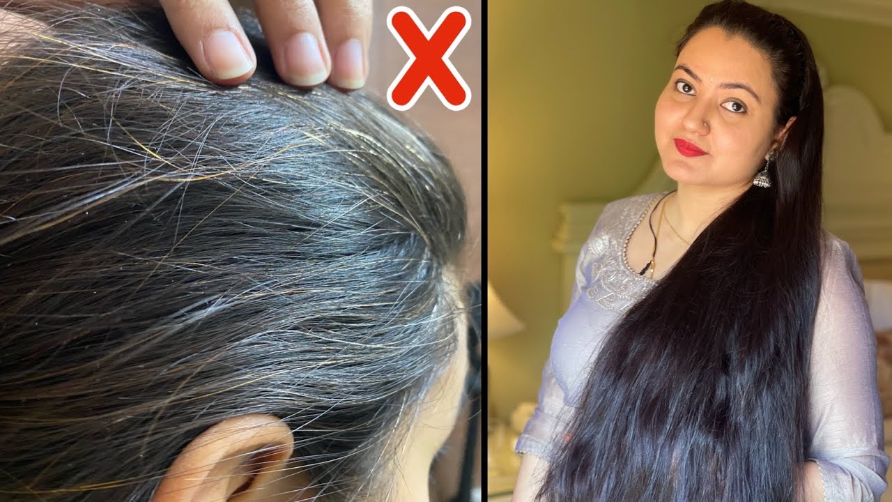 WHITE / GREY HAIR : Reasons & Treatment | Most Common Causes of Grey Hair