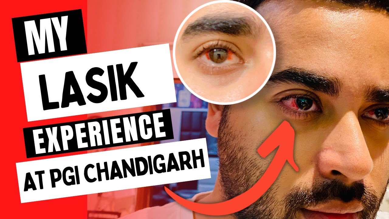 Got LASIK done from PGI CHANDIGARH | BLOODY🩸 RED EYES 👀  | too much Crowd | SD vlogs