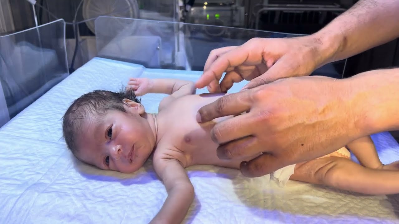 Last Cute Hugs | Brave NICU Baby Fighter Now Taking Feeding