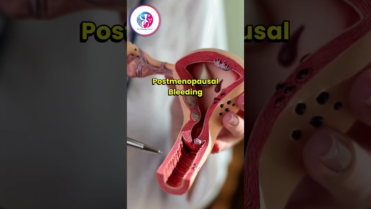Spotting or Bleeding After Menopause? Why Immediate Evaluation Is Needed | Dr. Mansha Grover