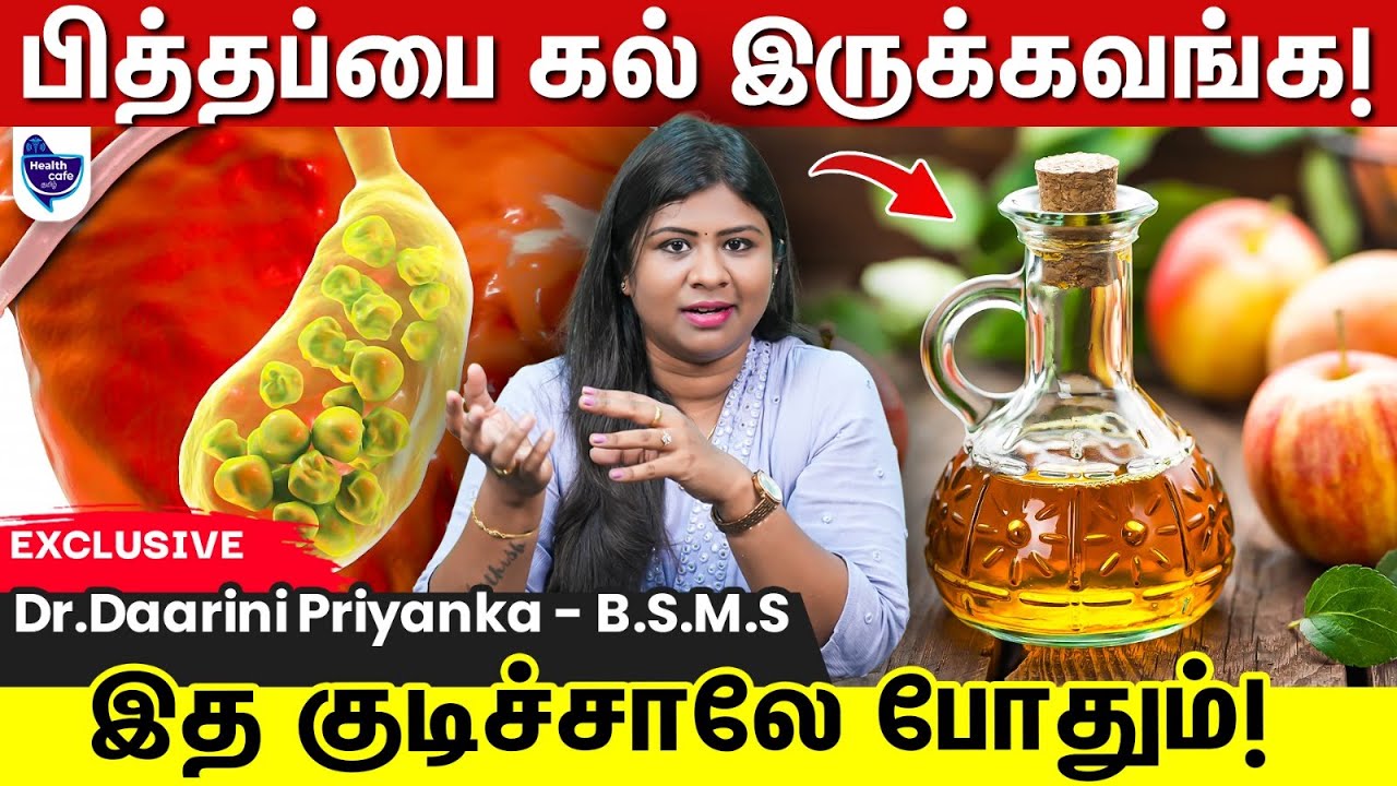 பித்தப்பை கற்களை கரைக்கும் டாப் 10 உணவுகள் !!