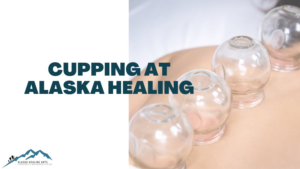 Cupping at Alaska Healing