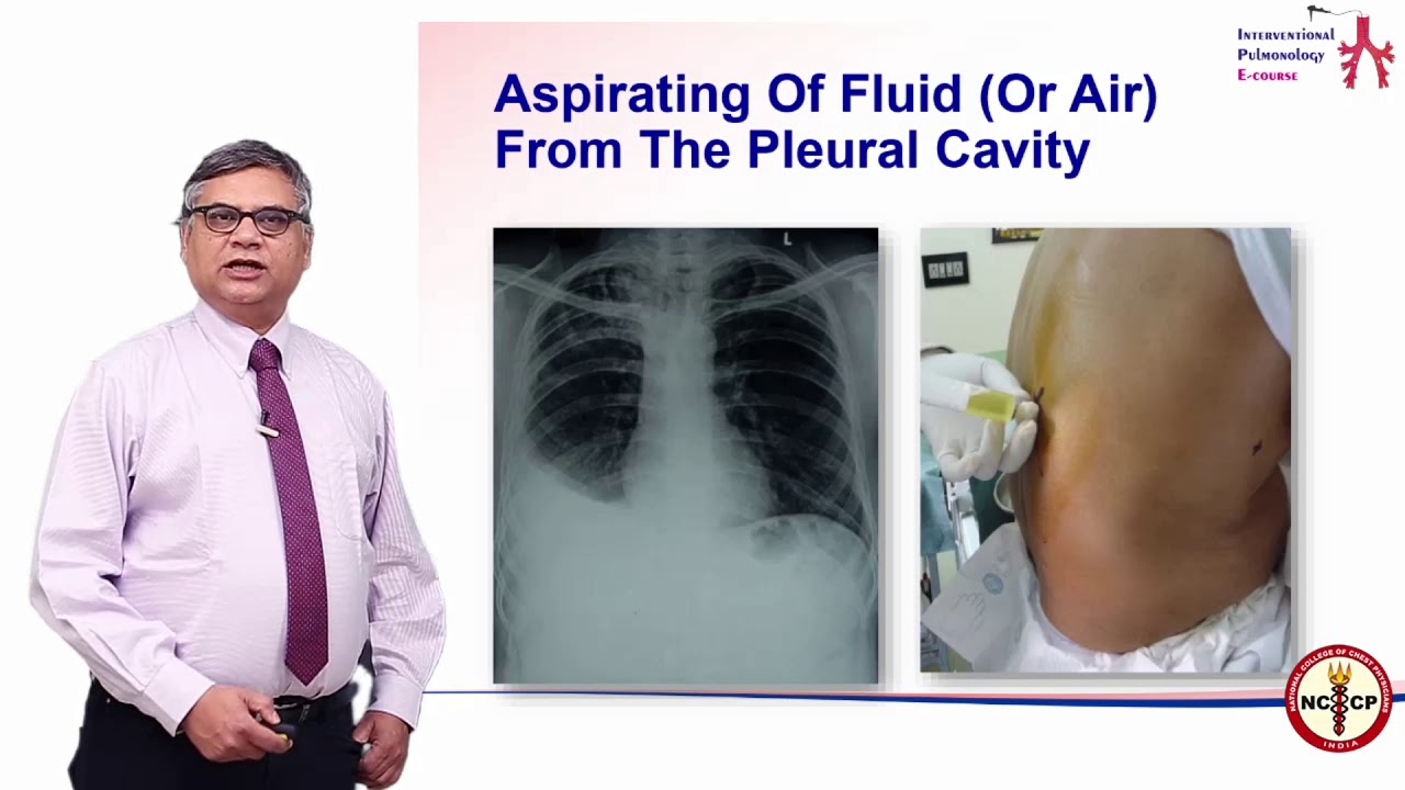 Pleurocentesis - Dr Dharmesh Patel - IPeC