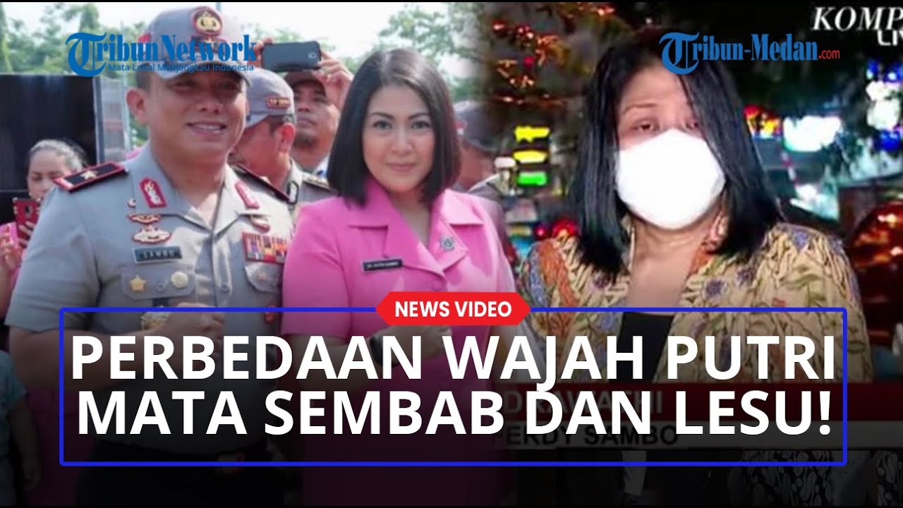 Kondisi Wajah Putri Candrawathi Jadi Sorotan Hingga Menangis Sebut Tulus Mencintai Ferdy Sambo!