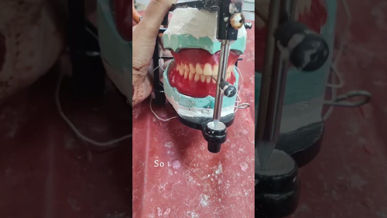 In a relationship with prosthodontics. It's complicated #dentalstudent #prosthodontics  #bdslife