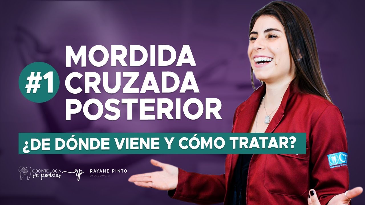 Mordida cruzada posterior (PARTE 1/3): ¿De dónde viene y cómo tratar ?