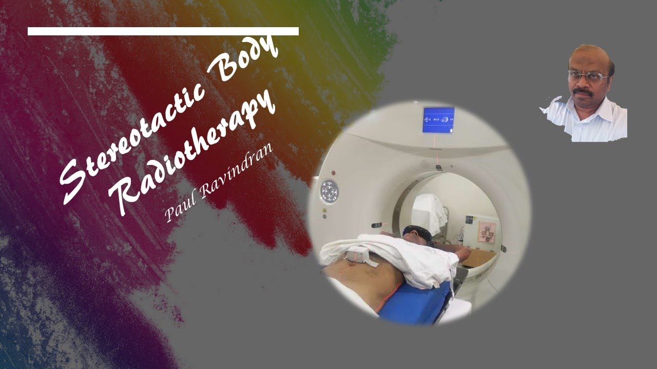 Stereotactic Body Radiotherapy