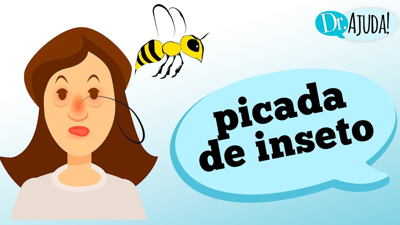 ALERGIAS DE PICADAS DE INSETO: Você tem? Como suspeitar?