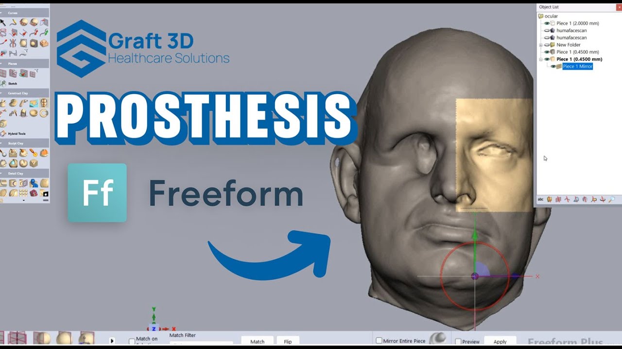 Midfacial Prosthesis Design Using Geomagic Freeform Software and Haptic Device