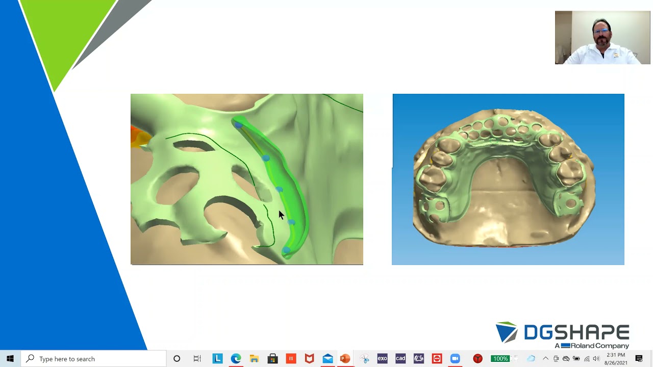 Digital Denture Milling Fast & Simplified