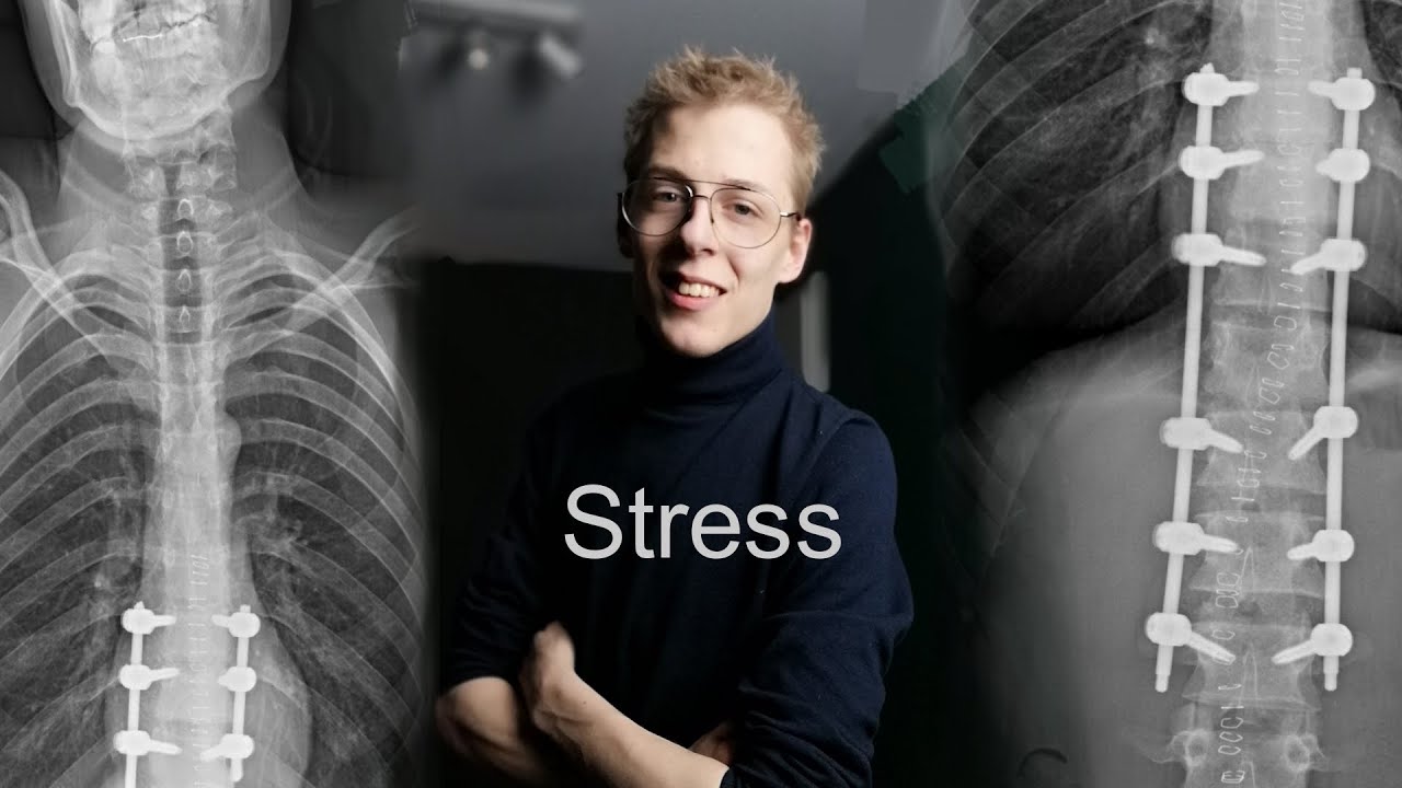 Was ist die letzten Monate passiert? #Hyperkyphose -Stress