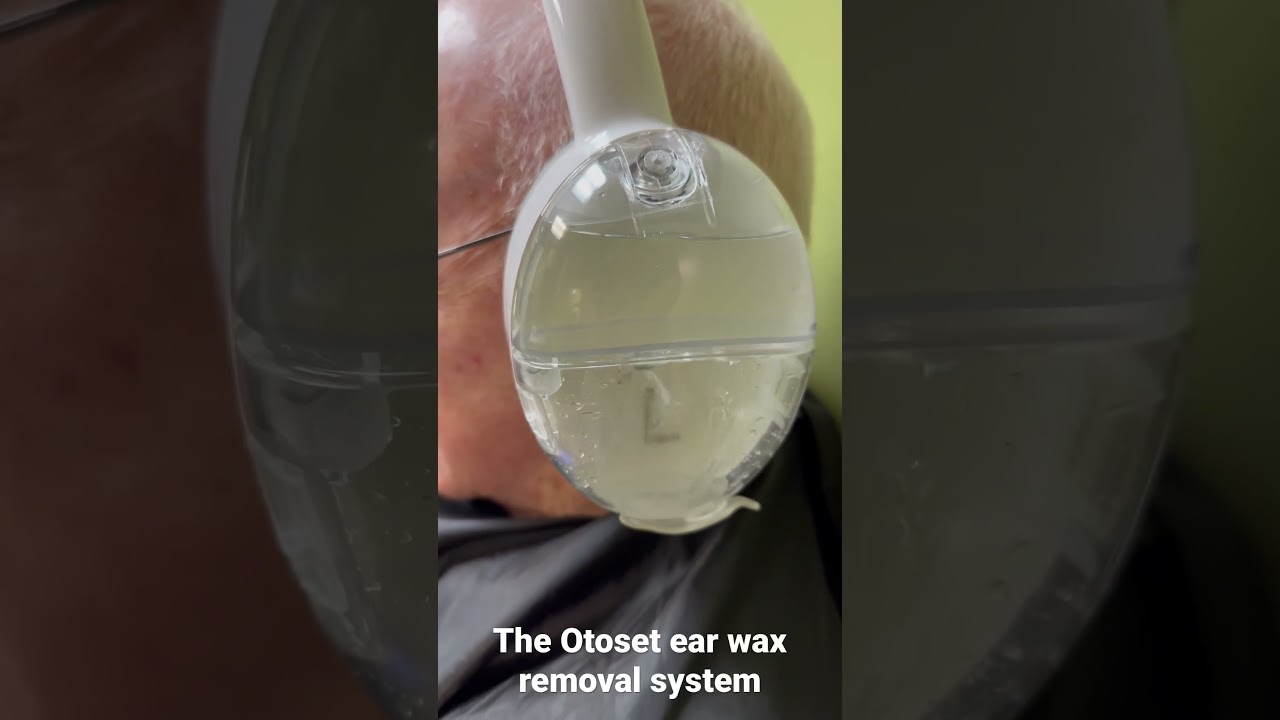Otoset ear wax removal system