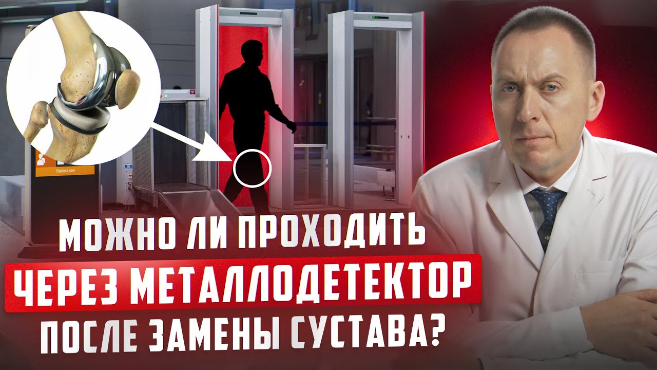Можно ли проходить через металлодетектор после замены коленного сустава?