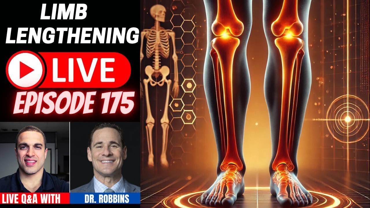 Limb Lengthening LIVE Ep. 175 – Surgeon Dr. Robbins from Paley Institute LIVE Q&A