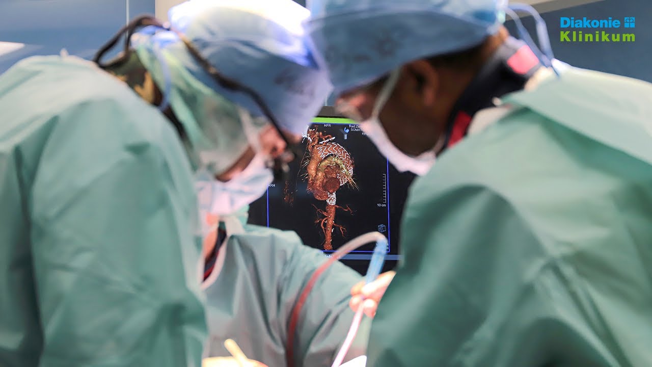 Aneurysmen des Aortenbogens: Neue Methode in der „Stilling“-Gefäßchirurgie