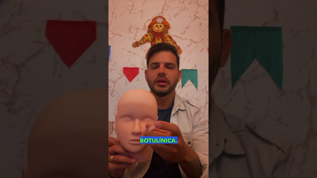 Toxina botulínica para sorriso gengival #toxinabotulinica #botox #botoxfacial #rejuvenecimento