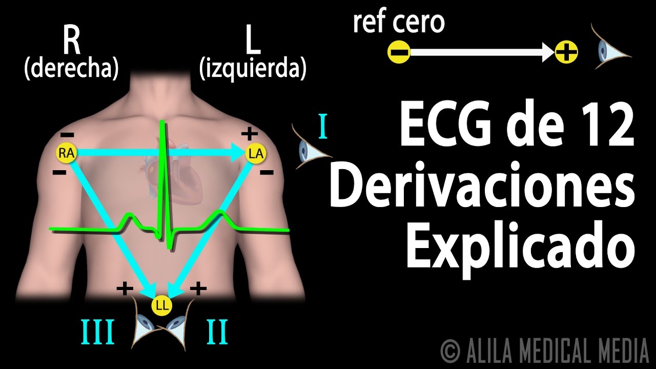 ECG de 12 Derivaciones Explicado, Animación.  Alila Medical Media Español.