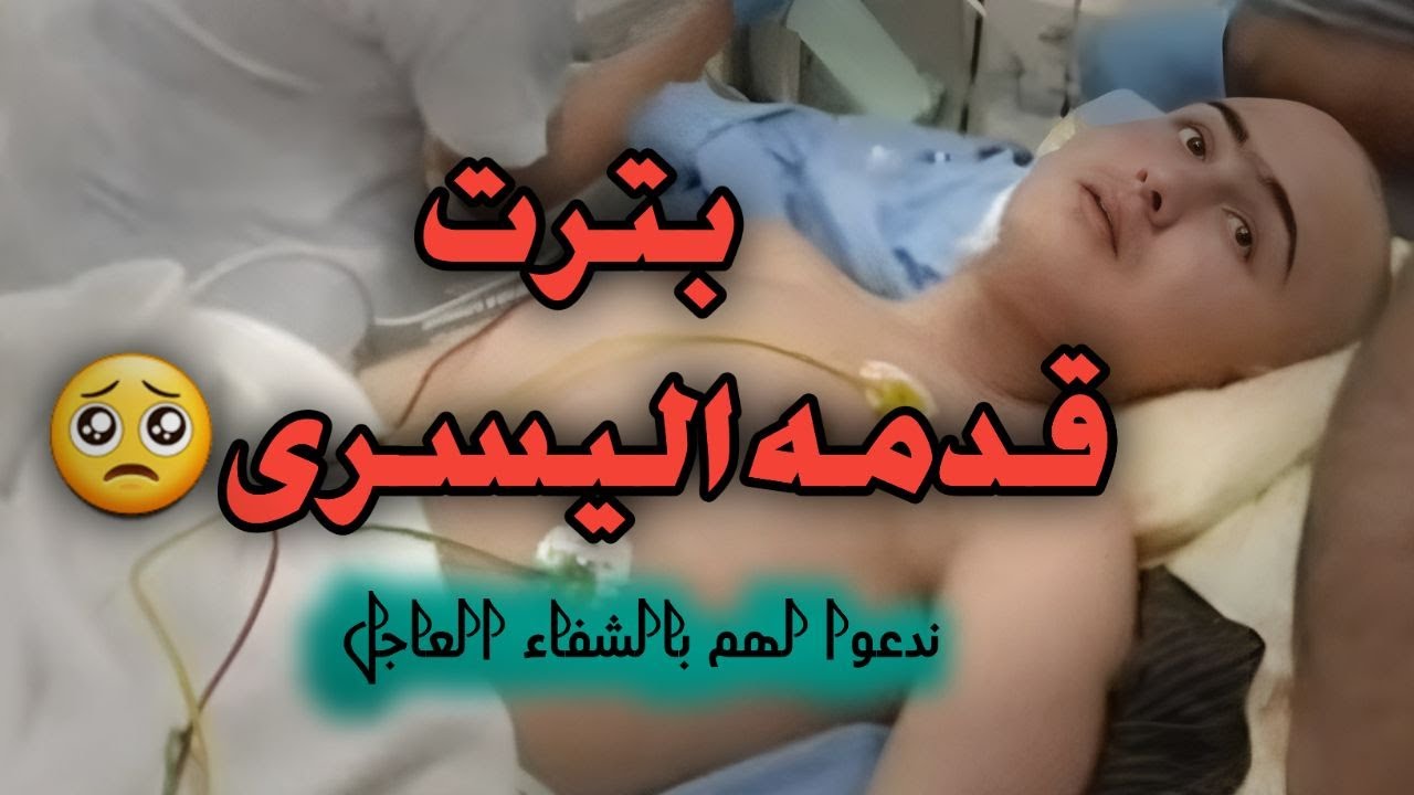 الطفله شام| الوضع الصحي لشام السوريه و أخوها عمر الشيخ محمد#زلزال #شام