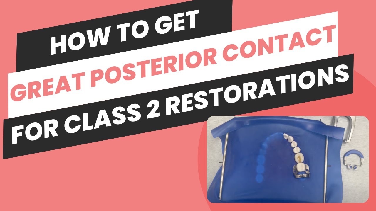 How To Achieve A Perfect Posterior Contact For Class II Restorations On Your ADEX Exam!