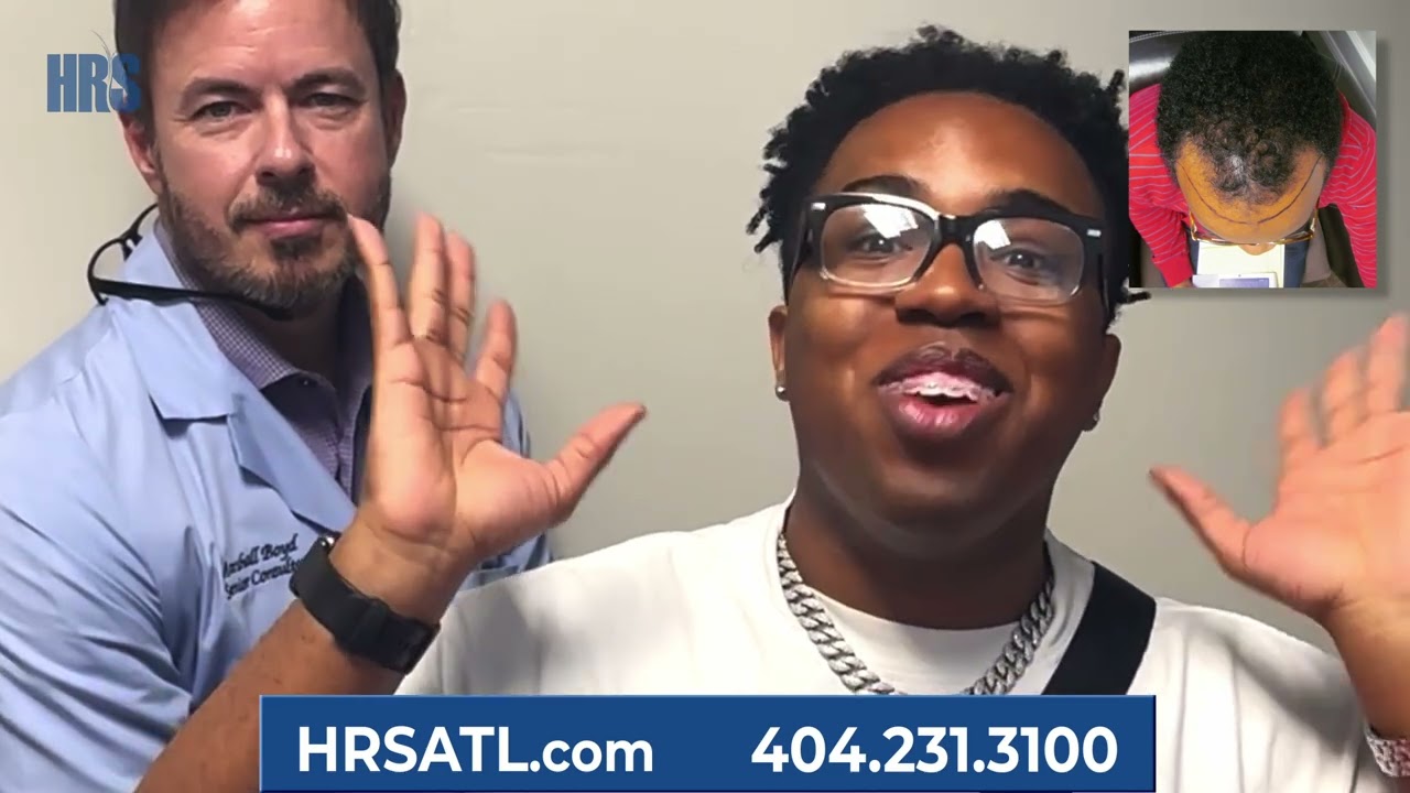 African American Hair Transplnt Done Right - Before and After