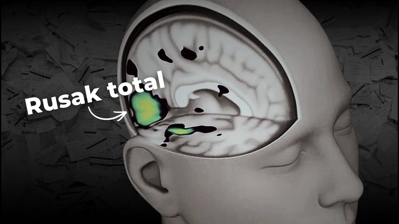 Dampak FATAL ChatGPT Buat Otak (kalau dipakai seenaknya)