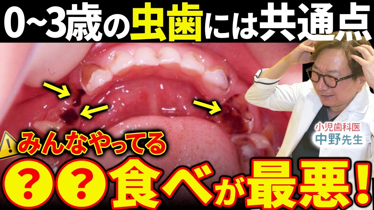 【赤ちゃんの虫歯予防】たった1つやめるだけ！0〜3歳の虫歯リスクを下げる習慣とは？