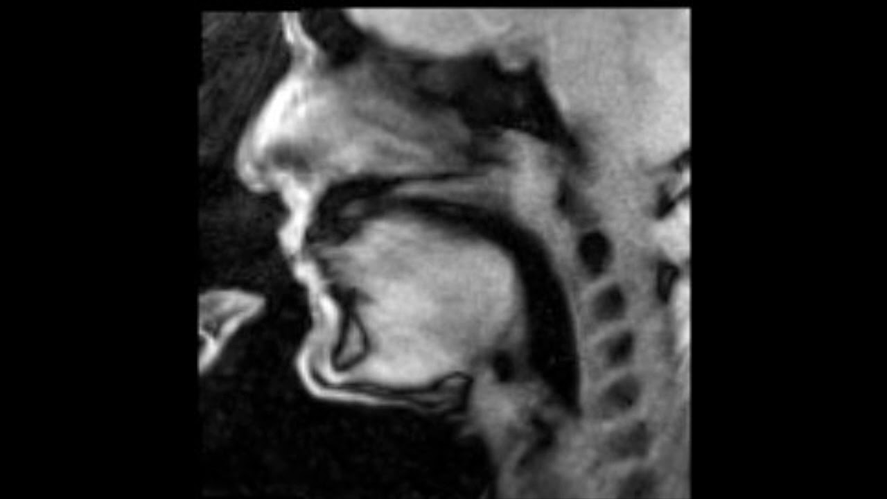 Douglas Yeo, trombone - MRI video 5 - fast double tongue (and slow motion video)