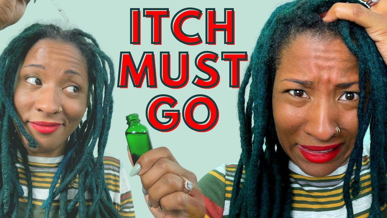 How to Get Rid of ITCHY SCALP with Locs