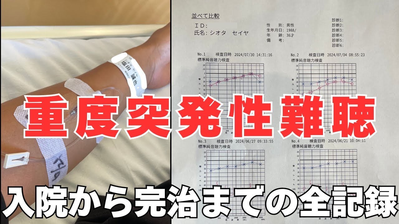 突発性難聴(grade4重度難聴)完治までの心境の変化